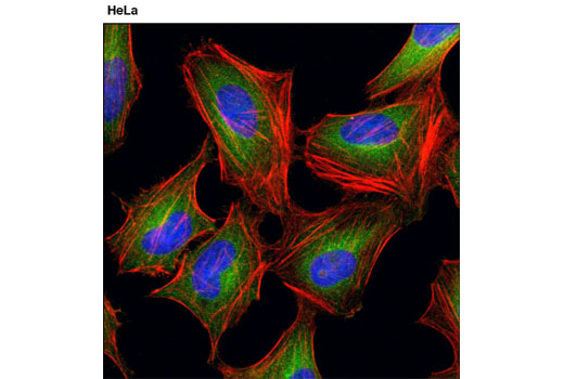 Immunofluorescence Image 1: MEK1/2 (D1A5) Rabbit mAb