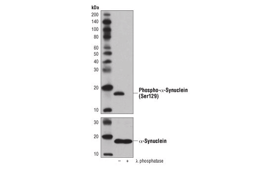 Western Blotting Image 1: Phospho-α-Synuclein (Ser129) (D1R1R) Rabbit mAb (BSA and Azide Free)