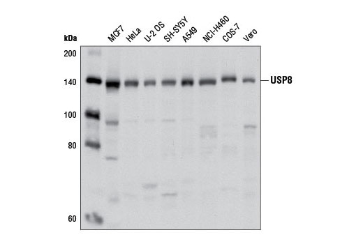 Western Blotting Image 1: USP8 Antibody