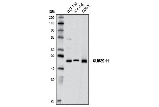  Image 8: Lysine Methyltransferase Antibody Sampler Kit
