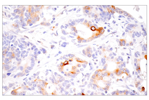 Immunohistochemistry Image 3: MMP-1 (E9S9N) Rabbit mAb (BSA and Azide Free)