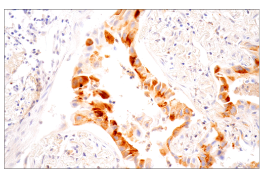 Immunohistochemistry Image 4: MMP-1 (E9S9N) Rabbit mAb (BSA and Azide Free)