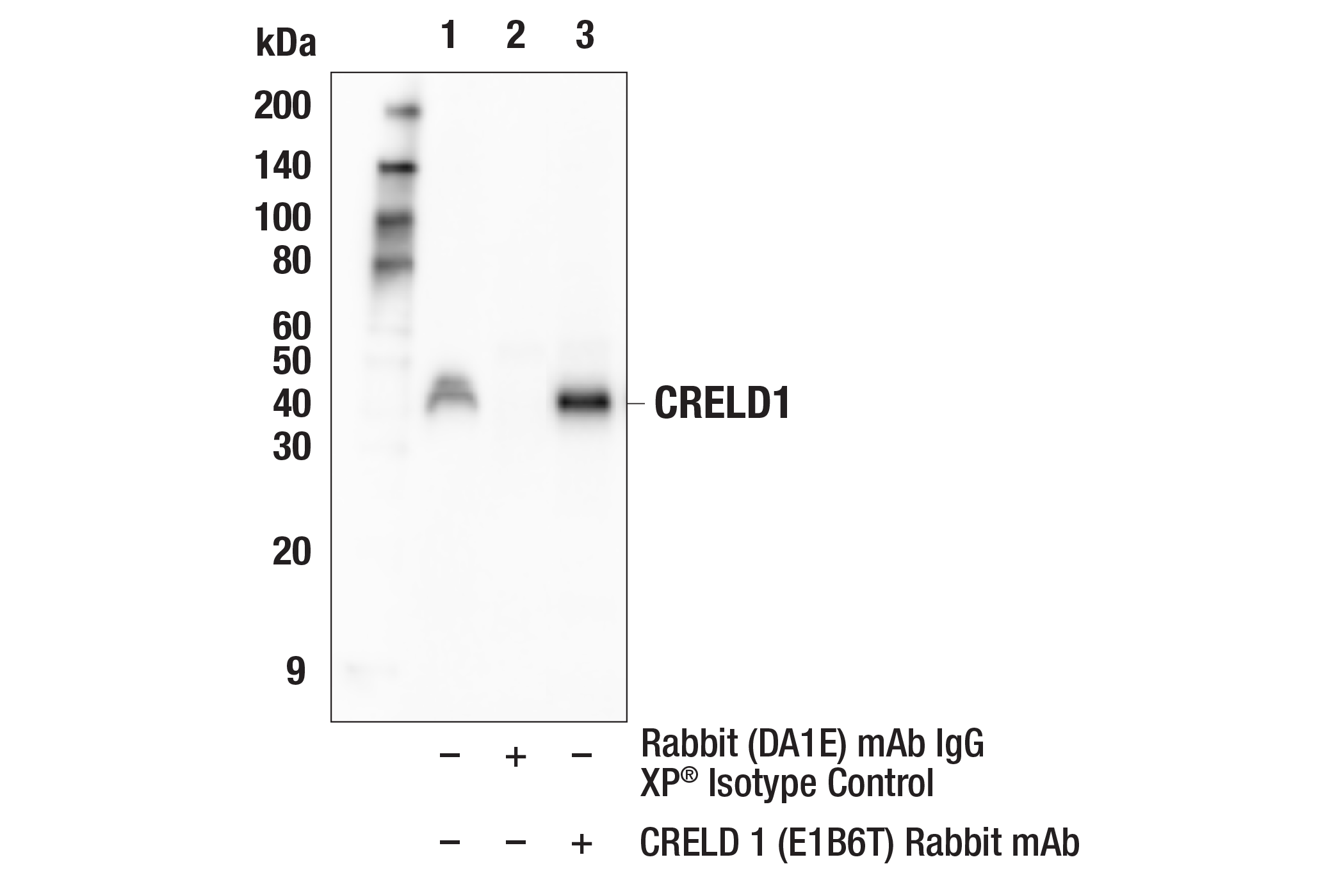 Immunoprecipitation Image 1: CRELD1 (E1B6T) Rabbit mAb
