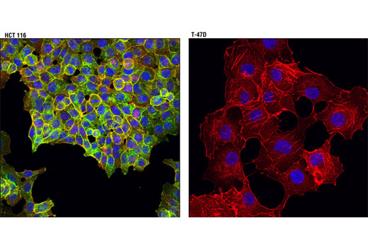 Immunofluorescence Image 1: Met (L6E7) Mouse mAb