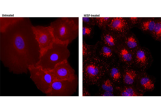 Immunofluorescence Image 1: EGF Receptor (D38B1) XP® Rabbit mAb (Alexa Fluor® 594 Conjugate)