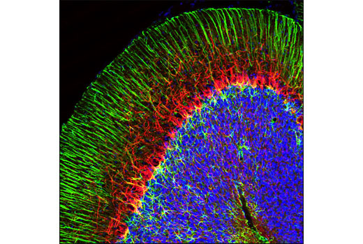 Immunofluorescence Image 1: Neurofilament-L (C28E10) Rabbit mAb (Alexa Fluor® 594 Conjugate)