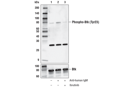  Image 3: PhosphoPlus® Btk (Tyr223) Antibody Duet