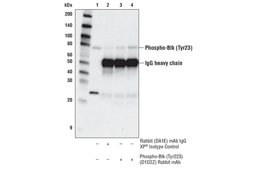 Immunoprecipitation Image 1: Phospho-Btk (Tyr223) (D1D2Z) Rabbit mAb