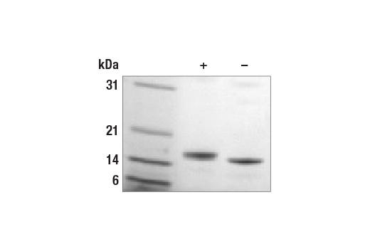  Image 1: Human IL-16 Recombinant Protein
