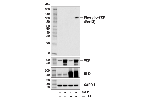 Western Blotting Image 1: Phospho-VCP (Ser13) Antibody
