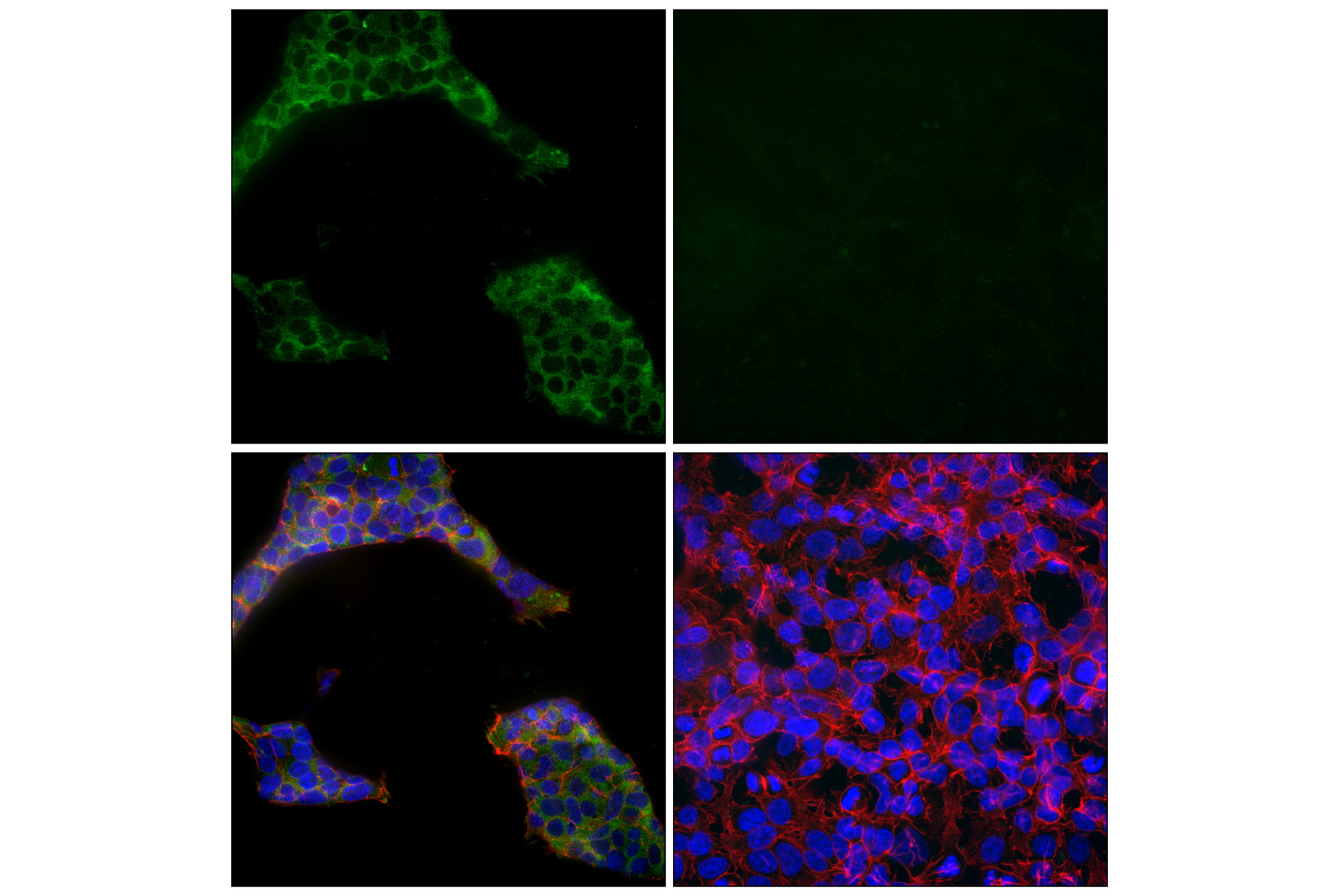 Immunofluorescence Image 1: 3X DYKDDDDK Tag (E7C5T) Rabbit mAb