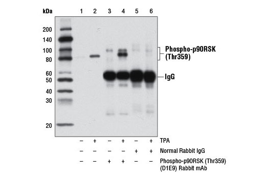 Immunoprecipitation Image 1: Phospho-p90RSK (Thr359) (D1E9) Rabbit mAb