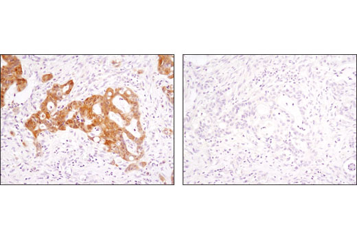Immunohistochemistry Image 3: Phospho-p90RSK (Thr359) (D1E9) Rabbit mAb