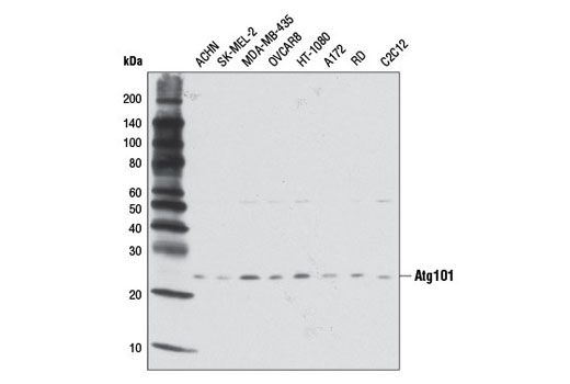Western Blotting Image 1: Atg101 Antibody