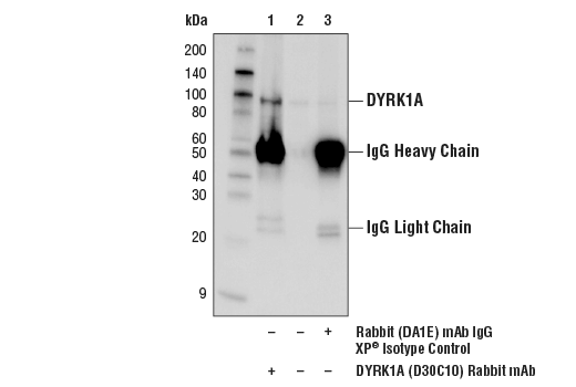 Immunoprecipitation Image 1: DYRK1A (D30C10) Rabbit mAb