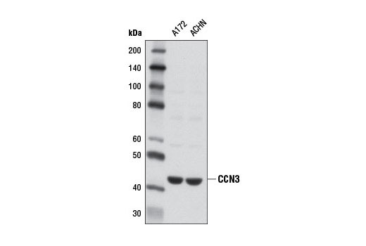 Western Blotting Image 1: CCN3 Antibody