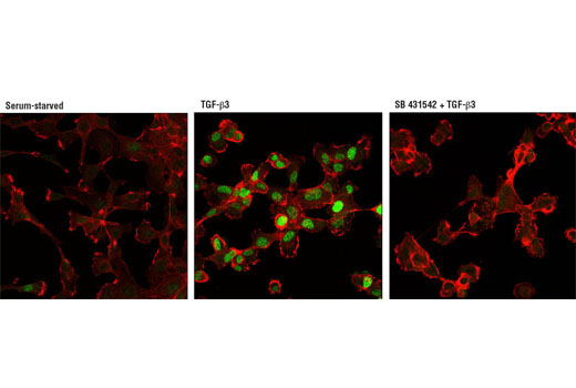Immunofluorescence Image 1: Phospho-Smad3 (Ser423/425) (D12E11) Rabbit mAb