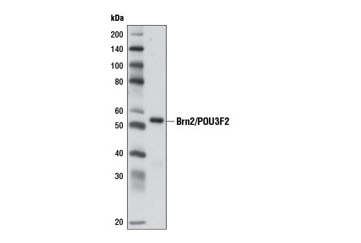 Anti-Brn-2 (POU3F2) Antibody, clone 8C4.2 clone 8C4.2, from mouse
