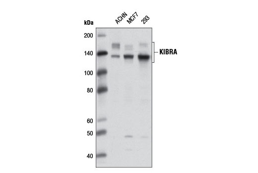 Western Blotting Image 1: KIBRA Antibody