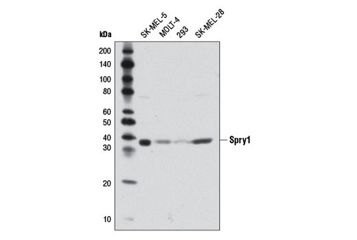 Western Blotting Image 1: Spry1 Antibody