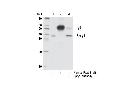 Immunoprecipitation Image 1: Spry1 Antibody