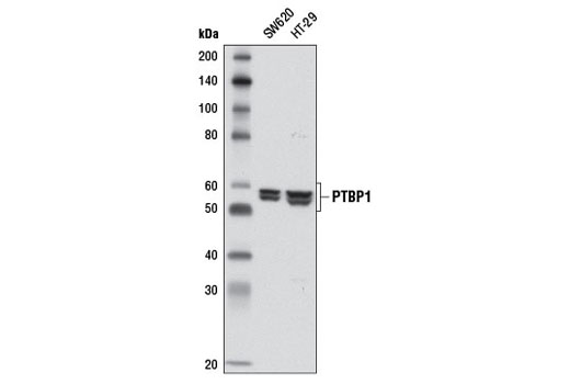 Western Blotting Image 1: PTBP1 Antibody