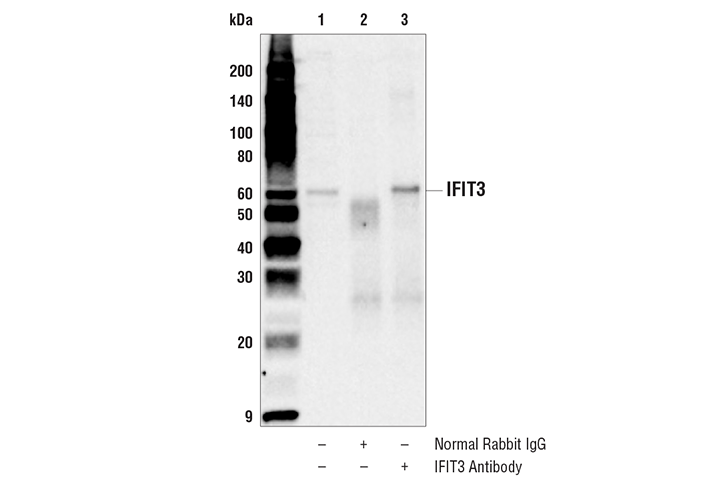 Immunoprecipitation Image 1: IFIT3 Antibody