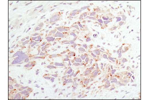 Immunohistochemistry Image 1: LAMTOR1/C11orf59 (D11H6) XP® Rabbit mAb (BSA and Azide Free)