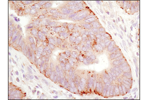 Immunohistochemistry Image 2: LAMTOR1/C11orf59 (D11H6) XP® Rabbit mAb (BSA and Azide Free)