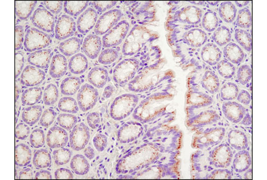 Immunohistochemistry Image 3: LAMTOR1/C11orf59 (D11H6) XP® Rabbit mAb (BSA and Azide Free)