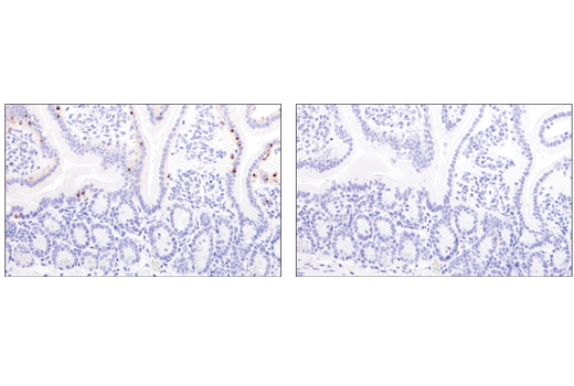 Immunohistochemistry Image 2: Granzyme B (E5V2L) Rabbit mAb (Mouse Specific) (BSA and Azide Free)