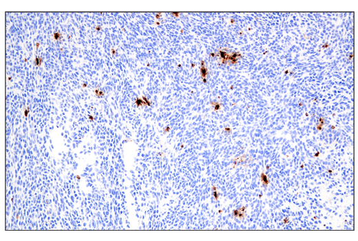 Immunohistochemistry Image 1: Granzyme B (E5V2L) Rabbit mAb (Mouse Specific) (BSA and Azide Free)