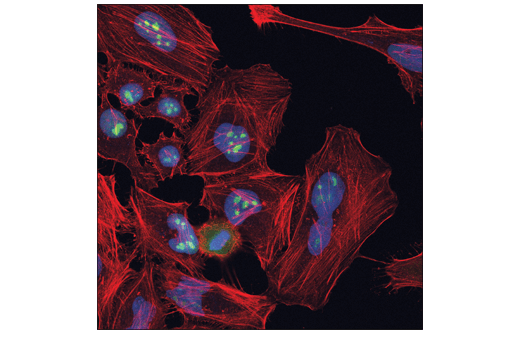 Immunofluorescence Image 1: Nucleolin (E5M7K) Mouse mAb
