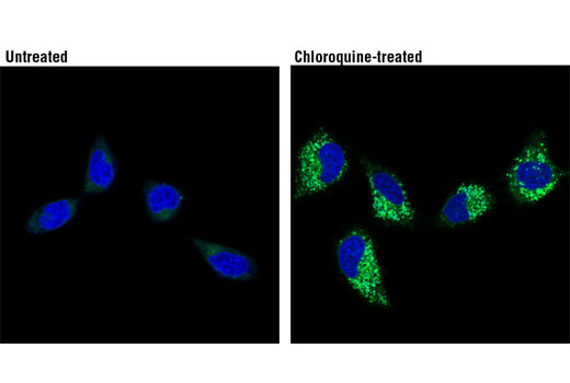 Immunofluorescence Image 1: LysoTracker® Green DND-26