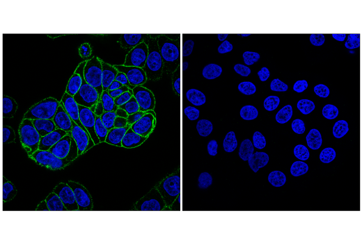 Immunofluorescence Image 1: Integrin α1/CD49a (E5D6Q) Rabbit mAb