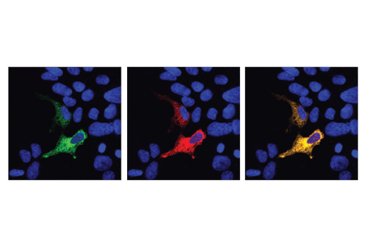 Immunofluorescence Image 1: Cas9 (S. aureus) (E4G3U) Rabbit mAb (BSA and Azide Free)