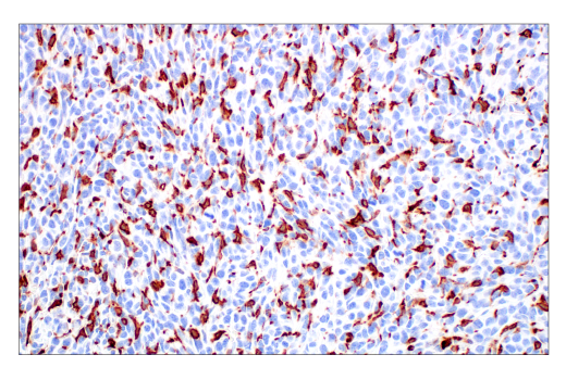 Immunohistochemistry Image 4: CD206/MRC1 (E6T5J) XP® Rabbit mAb (BSA and Azide Free)