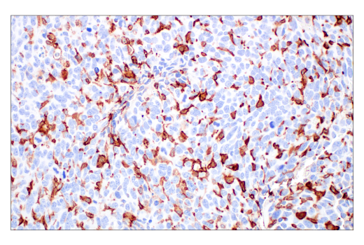 Immunohistochemistry Image 5: CD206/MRC1 (E6T5J) XP® Rabbit mAb (BSA and Azide Free)