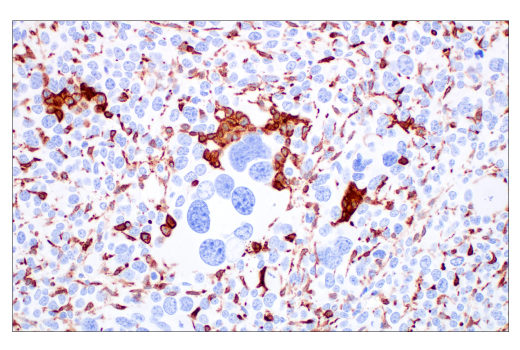Immunohistochemistry Image 6: CD206/MRC1 (E6T5J) XP® Rabbit mAb (BSA and Azide Free)
