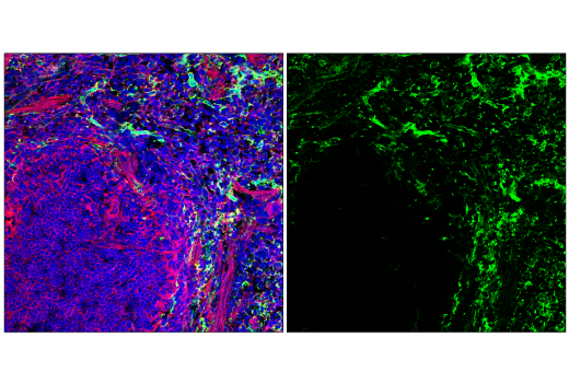 Immunofluorescence Image 1: CD206/MRC1 (E6T5J) XP® Rabbit mAb (BSA and Azide Free)