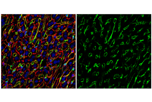 Immunofluorescence Image 2: CD206/MRC1 (E6T5J) XP® Rabbit mAb (BSA and Azide Free)
