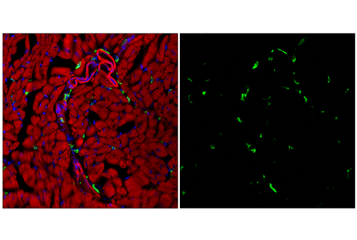 Immunofluorescence Image 3: CD206/MRC1 (E6T5J) XP® Rabbit mAb (BSA and Azide Free)