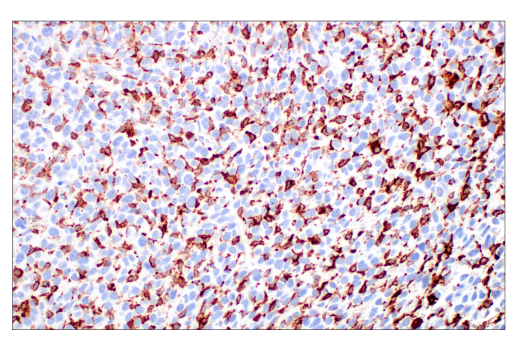 Immunohistochemistry Image 7: CD206/MRC1 (E6T5J) XP® Rabbit mAb (BSA and Azide Free)