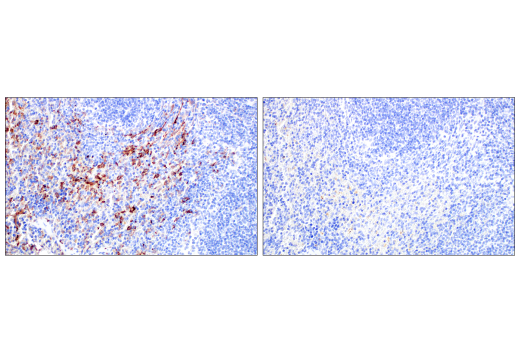 Immunohistochemistry Image 11: CD206/MRC1 (E6T5J) XP® Rabbit mAb (BSA and Azide Free)