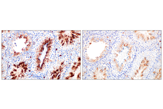 Immunohistochemistry Image 10: CD206/MRC1 (E6T5J) XP® Rabbit mAb (BSA and Azide Free)