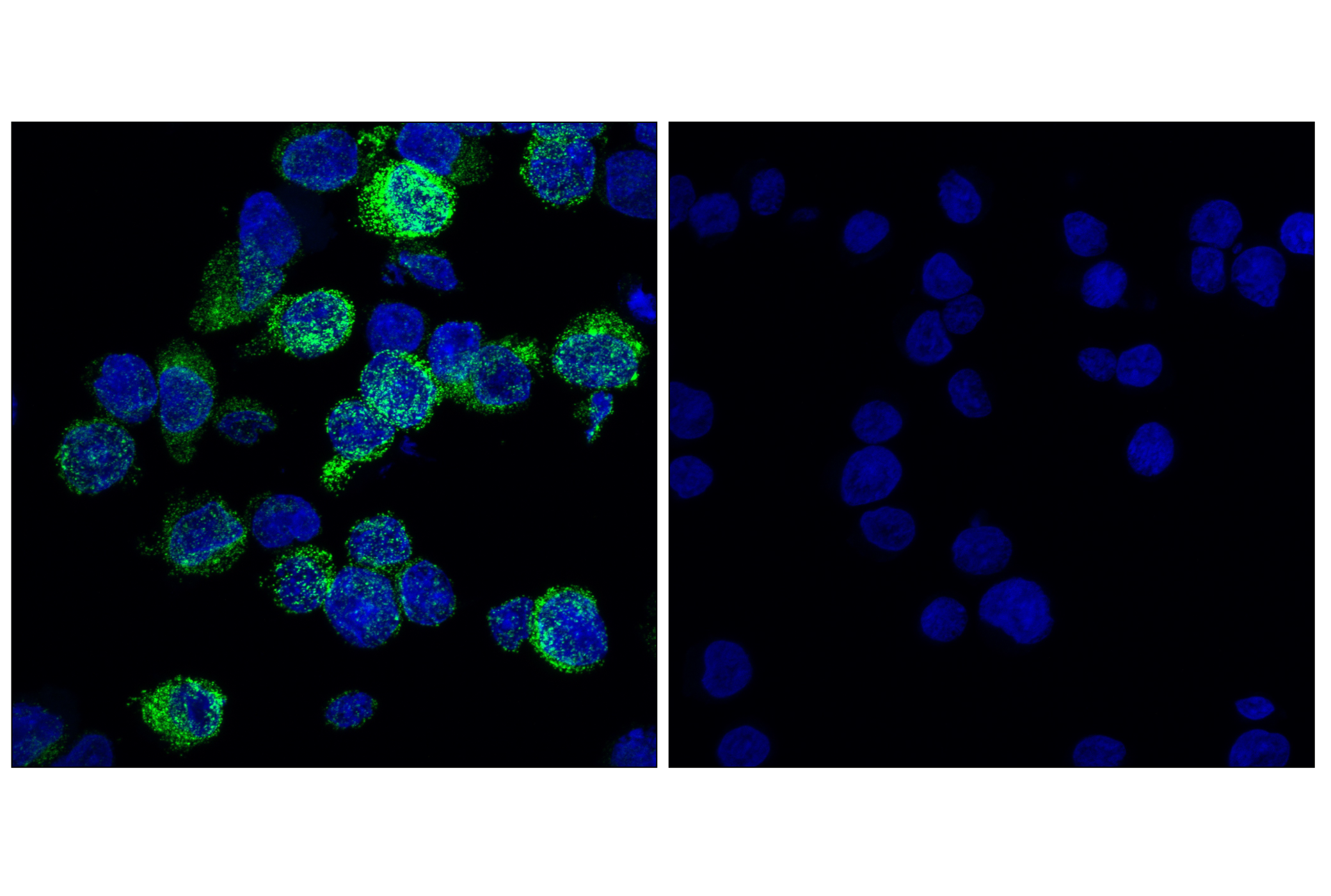 Immunofluorescence Image 4: CD206/MRC1 (E6T5J) XP® Rabbit mAb (BSA and Azide Free)