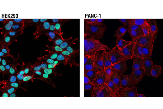 Immunofluorescence Image 1: NKX2.5 (E1Y8H) Rabbit mAb