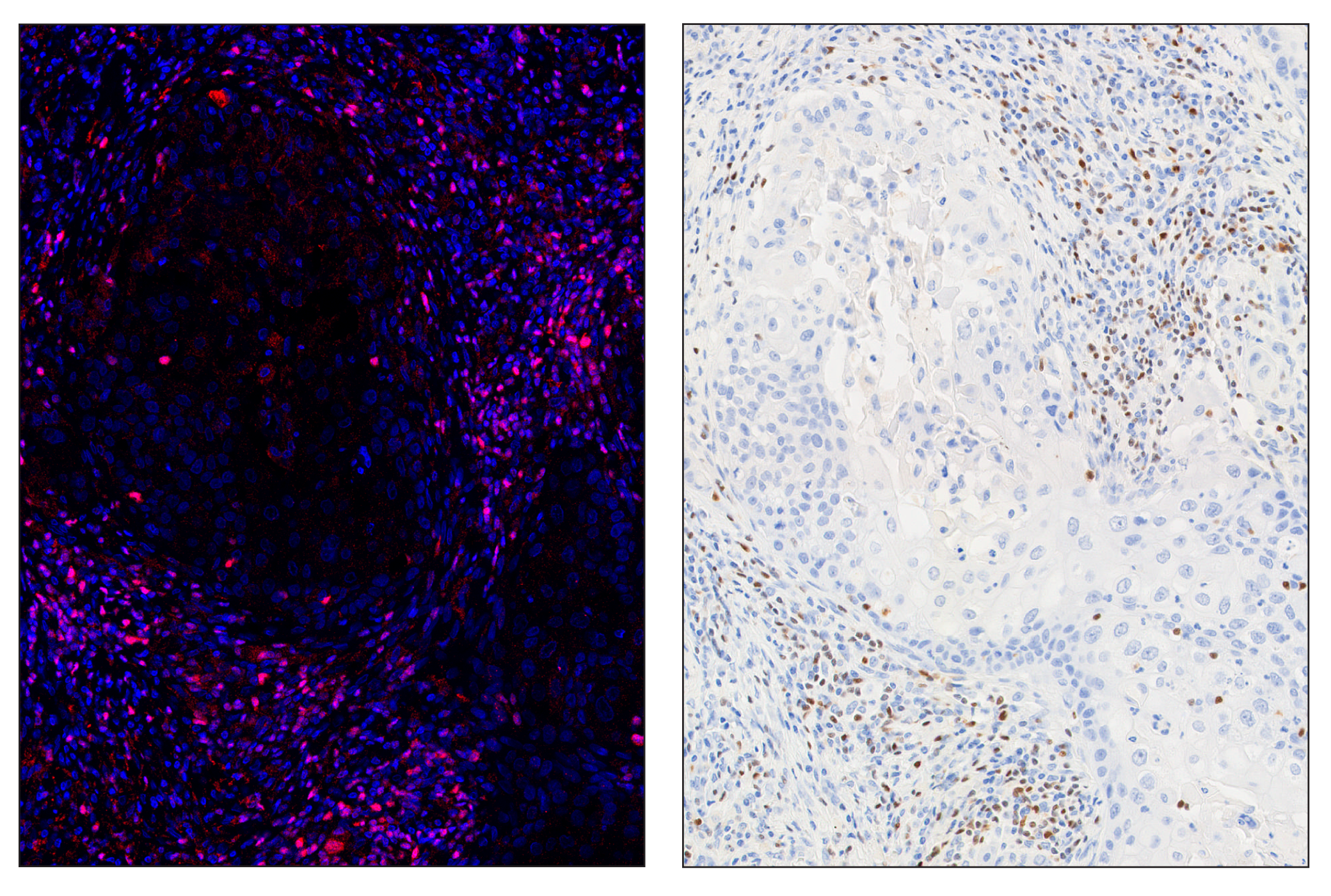 Immunohistochemistry Image 6: Tox/Tox2 (E6I3Q) & CO-0016-594 SignalStar™ Oligo-Antibody Pair