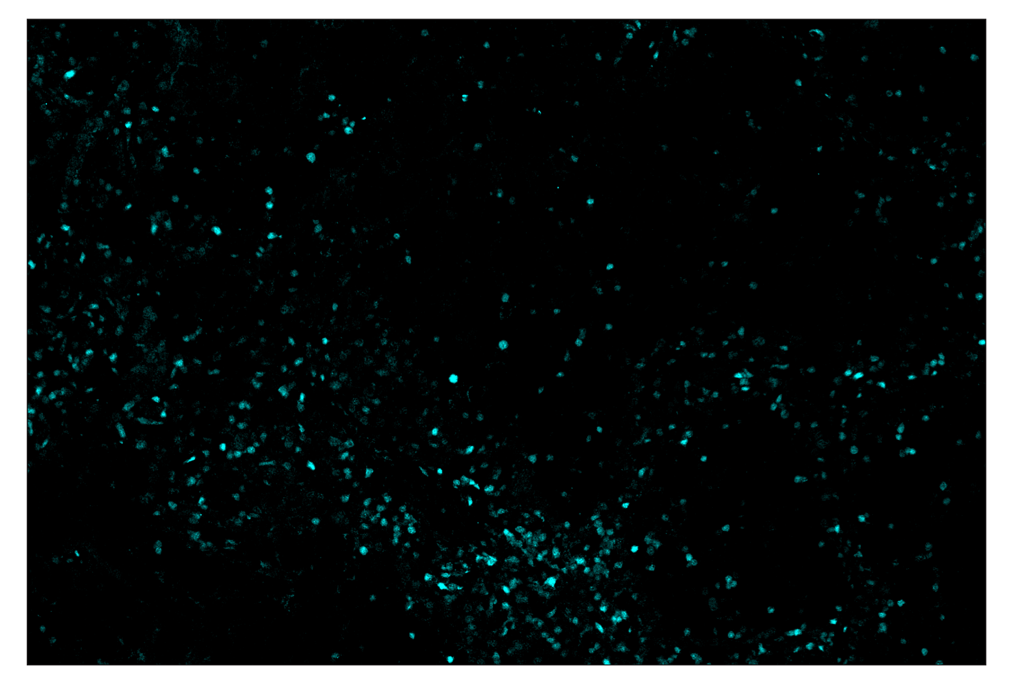 Immunohistochemistry Image 5: Tox/Tox2 (E6I3Q) & CO-0016-488 SignalStar™ Oligo-Antibody Pair