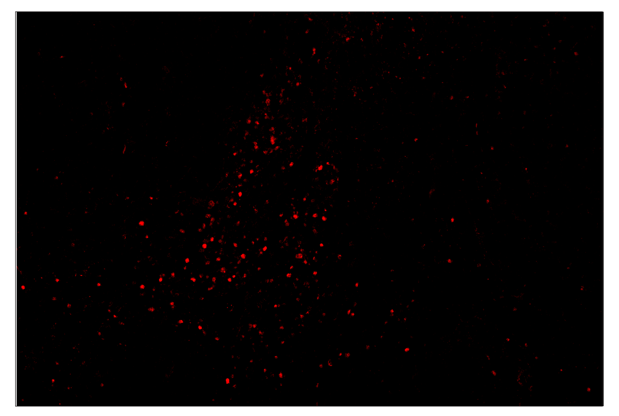 Immunohistochemistry Image 4: Tox/Tox2 (E6I3Q) & CO-0016-750 SignalStar™ Oligo-Antibody Pair